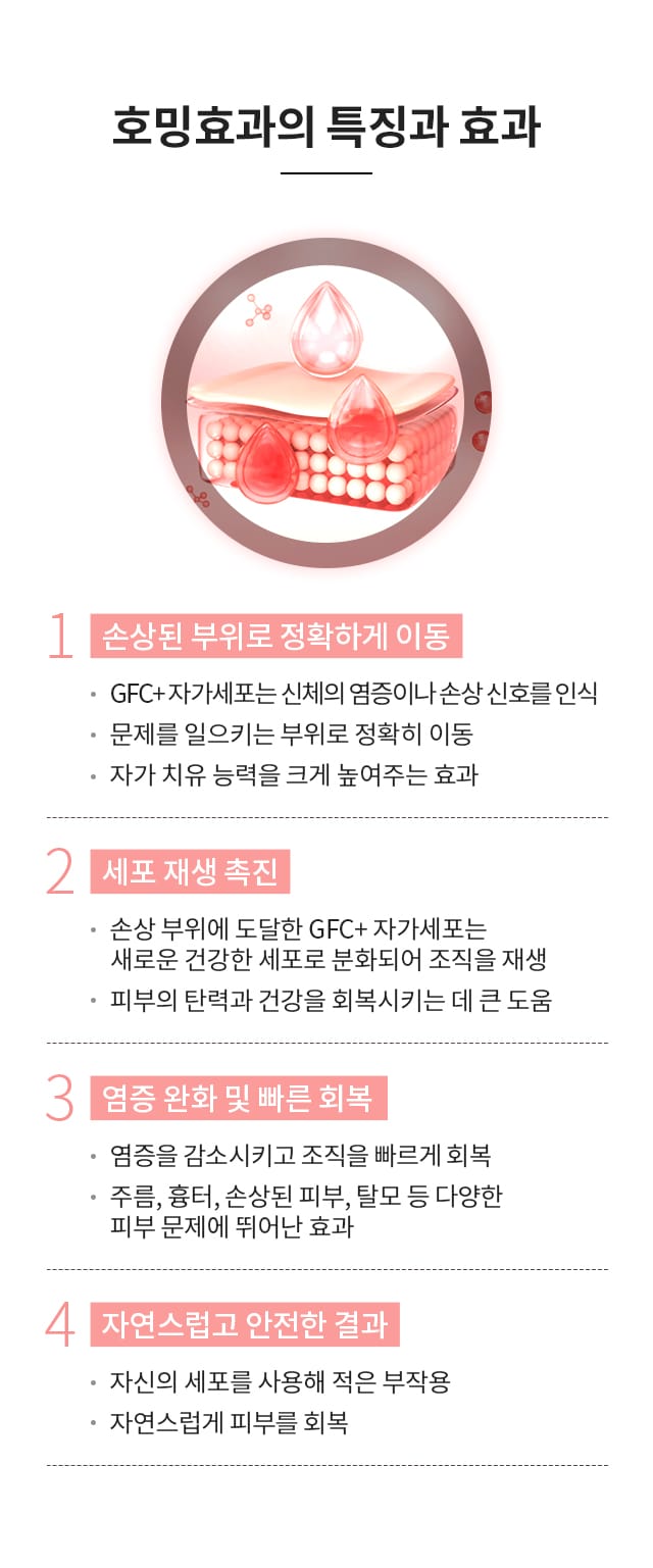 줄기세포 호밍효과의 특징와 효과