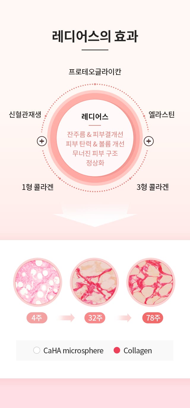 레디어스의 효과