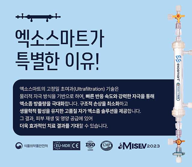 엑소스마트가 특별한 이유