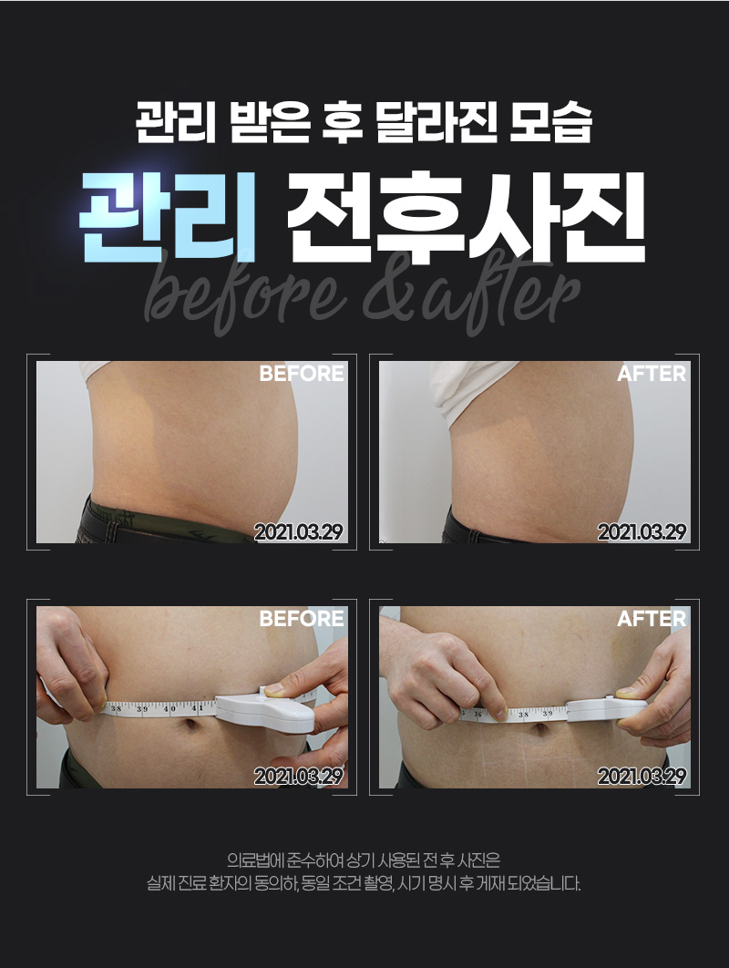 인스타그램-리니어펌-인모드-바디라인_09.jpg