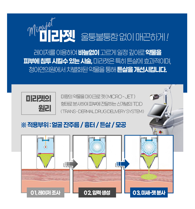 인스타그램-리니어펌-인모드-바디라인_06.jpg