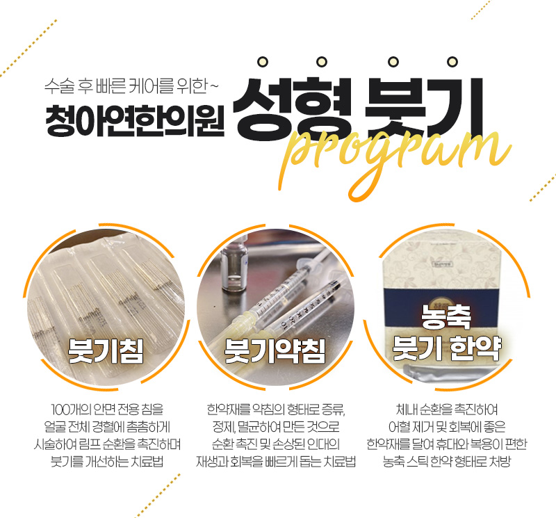 인스타그램-성형-후-붓기-관리_06.jpg