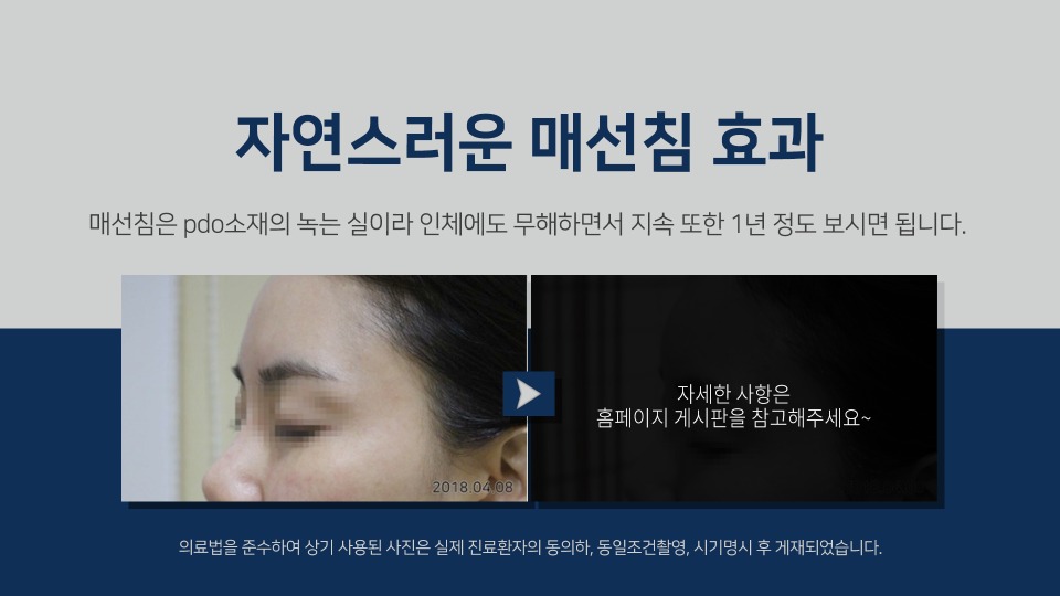 꺼진이마2.jpg