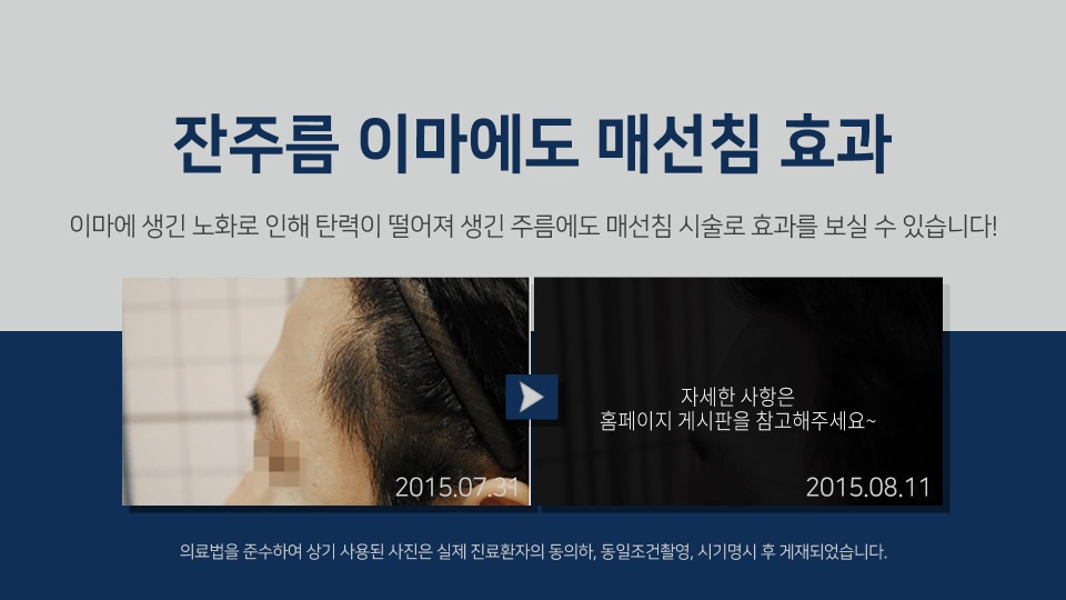 꺼진이마4.jpg