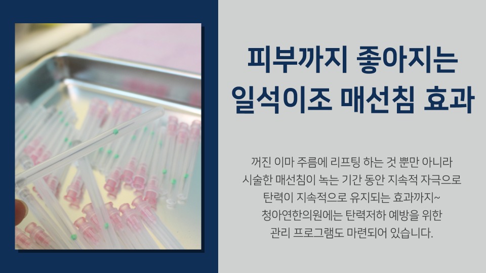 꺼진이마5.jpg