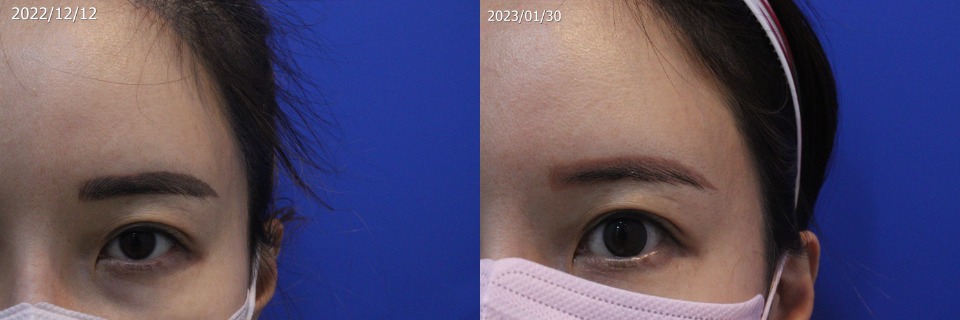 221212_전사진_좌-horz.jpg