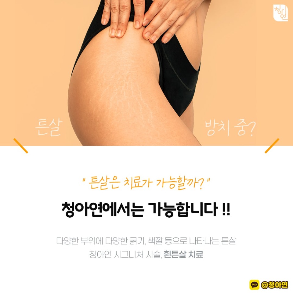 흰튼살1.jpg