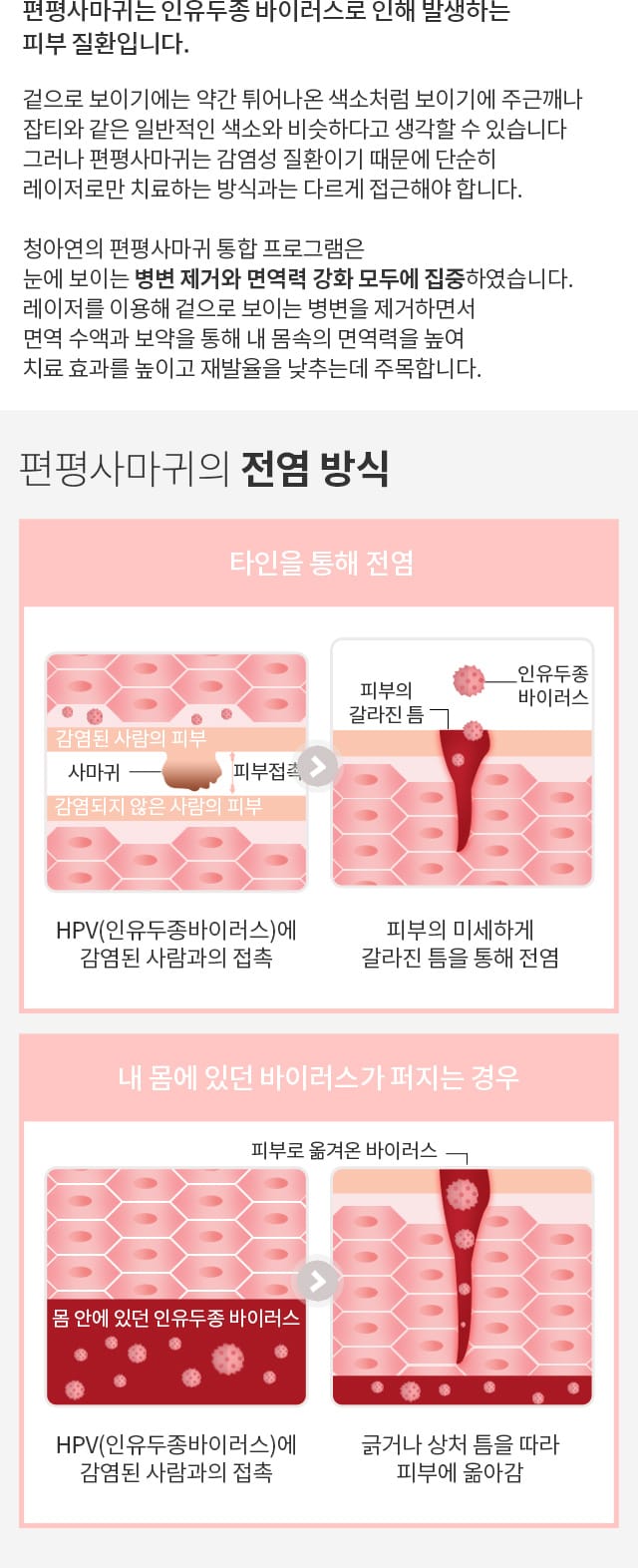 편평사마귀는 인유두종 바이러스로 인해 발생하는 피부 질환입니다. / 전염방식 / 퍼지는 방식